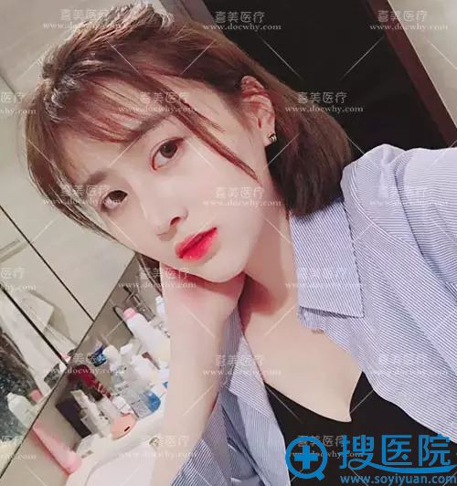 可以用别人的肋软骨隆鼻吗?科上海喜美<!--<i data=20240710 data-id=16268></i>-->异体肋软骨隆鼻案例 可以用别人的肋软骨隆鼻吗?科上海喜美<!--<i data=20240710 data-id=16268></i>-->异体肋软骨隆鼻案例