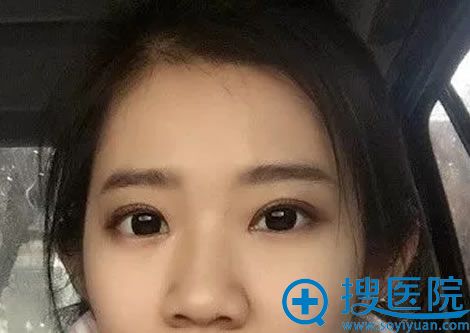 ����ʽ����˫��Ƥ����15��ָ�Ч��