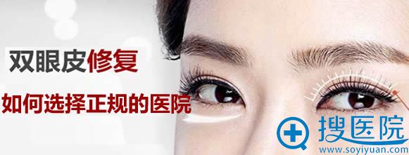 必看!田国静告知你双眼皮整形失败后如何选择正规的医院做修复