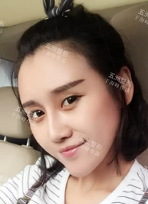 外貌协会的我选择北京五洲医美于海峰做面部脂肪填充和眼鼻整形