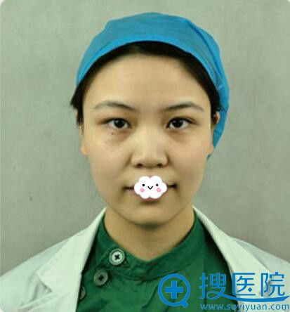 兰州亚韩员工曝光徐陇豫院长综合隆鼻手术过程——塌鼻子逆袭记