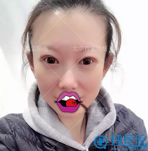 ѡ�������������۴�����30��Ч��