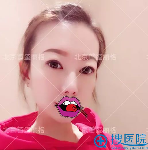 �����۴���˫��Ƥ3���»ָ���
