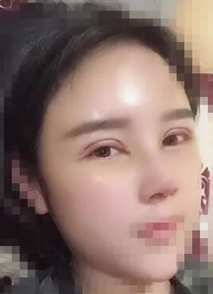 Ϊ�˱�Ư��������������˫��Ƥ+�沿֬�����+��ǽ�������10��