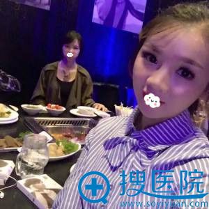 看贵阳美贝尔丁梅丝国产硅胶假体隆鼻案例效果 了解哪隆鼻好?
