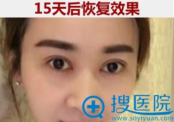 <!--<i data=20240710 data-id=9115></i>-->������<!--<i data=20240710 data-id=16650></i>-->˫��Ƥ�Ϳ��۽�15��Ч��ͼ