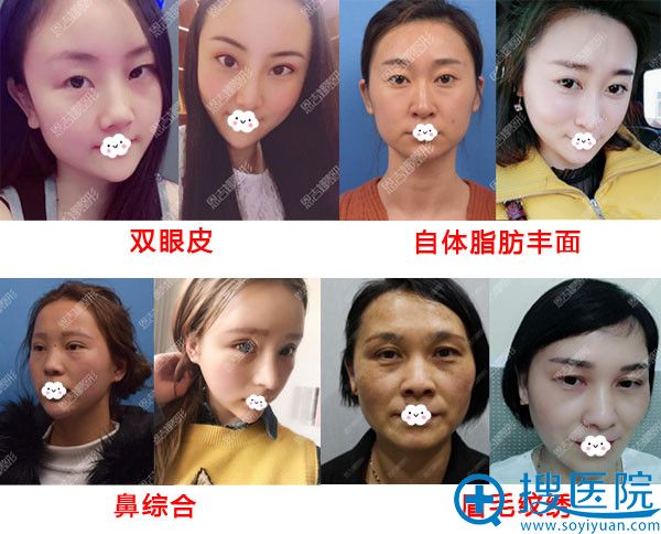 恩吉娜整形医院的真人案例 恩吉娜整形医院的真人案例