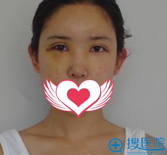 20180628_1530177577766796.jpg 颜_副本.jpg