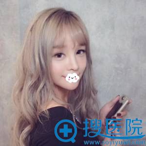 深圳贝漾美天双眼皮术后效果 深圳贝漾美天双眼皮术后效果