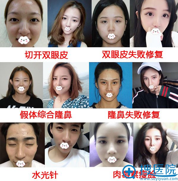 <!--<i data=20240710 data-id=8402></i>-->整形真人案例效果对比 <!--<i data=20240710 data-id=8402></i>-->整形真人案例效果对比