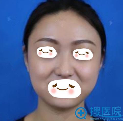 ���ൺҼ������¡��+ȫ������֬���������ۣ���˵�һ�������