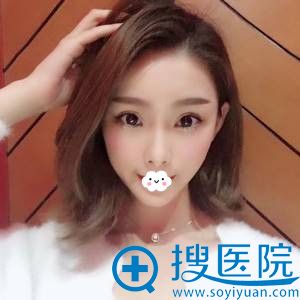 <!--<i data=20240710 data-id=12503></i>-->李俊双眼皮+开眼角真人案例 <!--<i data=20240710 data-id=12503></i>-->李俊双眼皮+开眼角真人案例