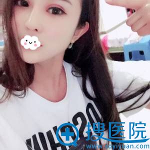 <!--<i data=20240710 data-id=11795></i>-->付国友非假体隆鼻效果怎么样 <!--<i data=20240710 data-id=11795></i>-->付国友非假体隆鼻效果怎么样