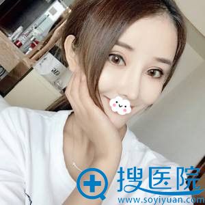 <!--<i data=20240710 data-id=11795></i>-->鼻部综合整形效果 <!--<i data=20240710 data-id=11795></i>-->鼻部综合整形效果