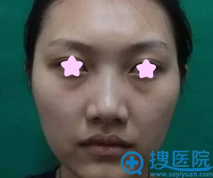 ���Ұ��ݵ��沿 ������˼��Τ�ķ�������֬������䱥������
