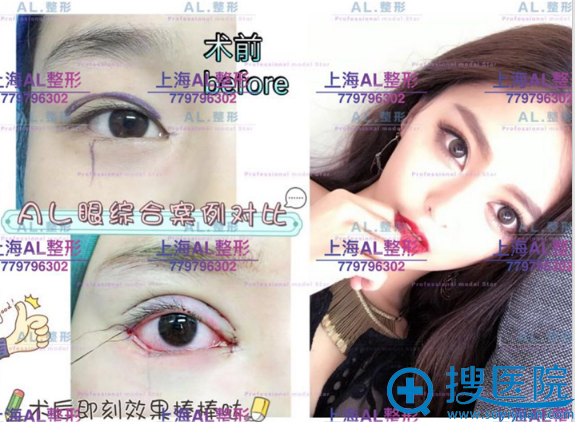 上海al<span style= 上海al<span style=
