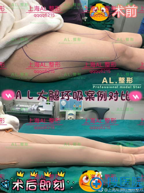 上海al<span style= 上海al<span style=
