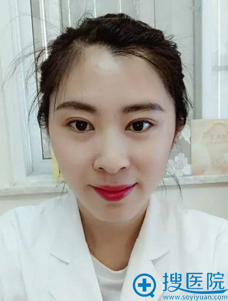 天津美莱毕小丽做的双眼皮术后七天拆线效果 天津美莱毕小丽做的双眼皮术后七天拆线效果