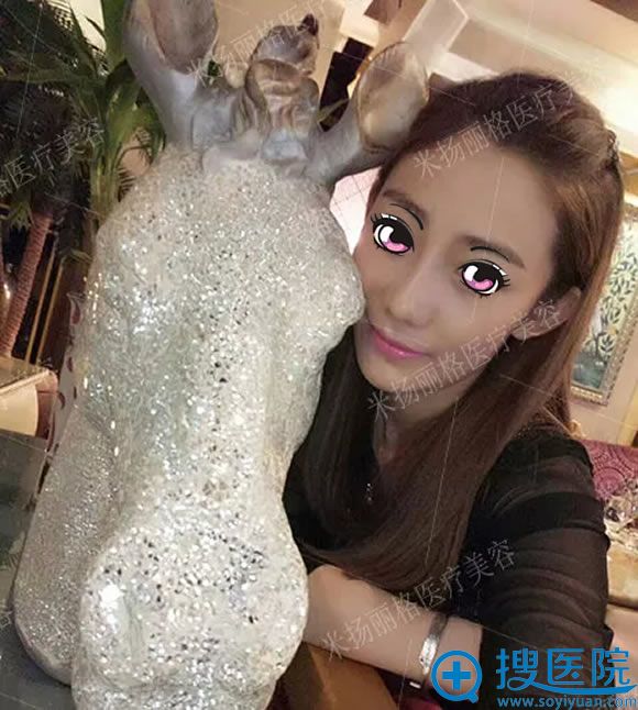 找北京夏正义做宽鼻修复3个月后 找北京夏正义做宽鼻修复3个月后