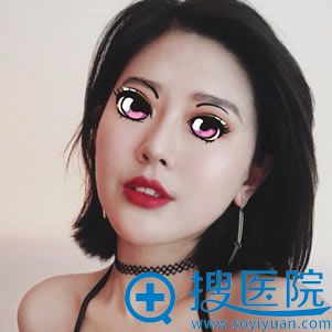 找叶子鲁礼新做隆鼻5个月后 找叶子鲁礼新做隆鼻5个月后