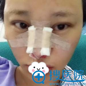 ���ڹ�������ǲ��ۺ�����Ч����ô��