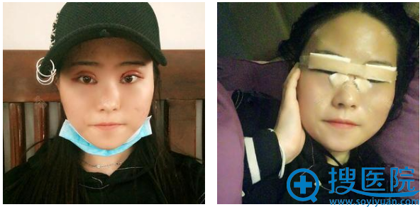 �ҽ���������ҽԺ��������˫��Ƥ��