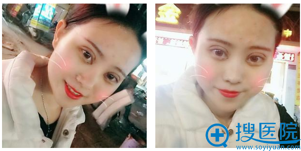 ȥ����������ҽԺ����˫��Ƥ��������