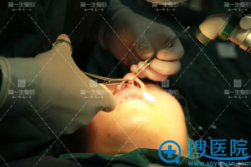 西安高一生金磊鼻修复过程图 西安高一生金磊鼻修复过程图
