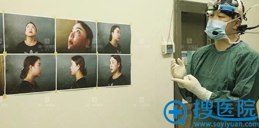 西安高一生隆鼻术前方案设计 西安高一生隆鼻术前方案设计