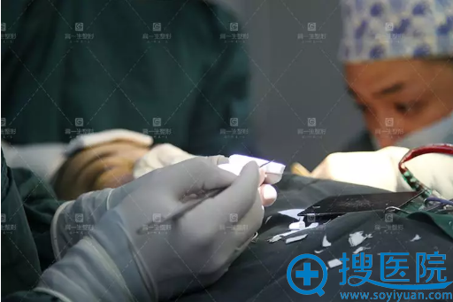 西安高一生隆鼻采用正规隆鼻材料 西安高一生隆鼻采用正规隆鼻材料
