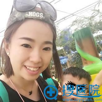 在华韩做过双眼皮和开眼角后才知道柳民熙院长做眼睛技术真是好