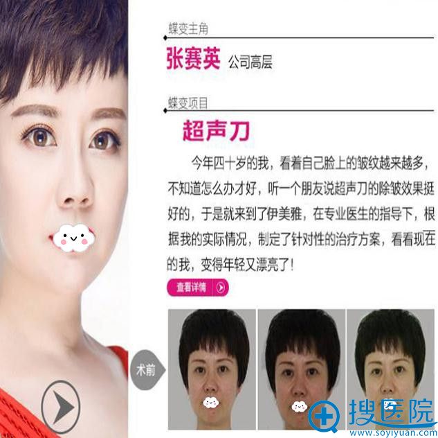 <!--<i data=20240710 data-id=9126></i>-->真实效果前后对比 <!--<i data=20240710 data-id=9126></i>-->真实效果前后对比