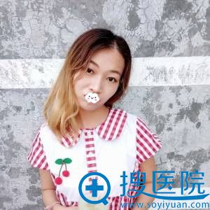 福州比华利切开双眼皮真人效果 福州比华利切开双眼皮真人效果