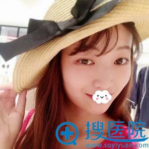 福州比华利双眼皮效果好吗 福州比华利双眼皮效果好吗