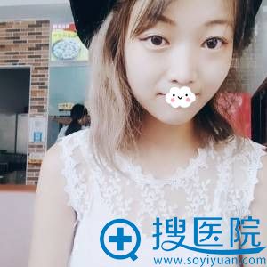 福州比华利整形美容医院双眼皮案例 福州比华利整形美容医院双眼皮案例
