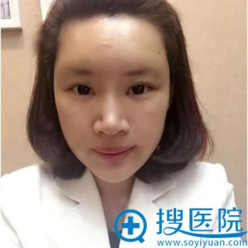 在北京丽都做脂肪填充4天效果 在北京丽都做脂肪填充4天效果