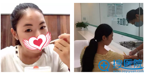 来河南整形医院找聂丽丽做双眼皮前的照片 来河南整形医院找聂丽丽做双眼皮前的照片