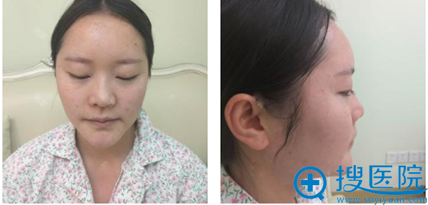û�뵽ֻ���ҳ�ɳ�Ǻ�����ҽԺ֣�������˸�¡�Ǳ仯��Ȼ��ô��