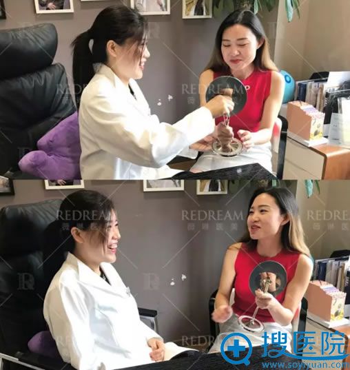 快看北京薇琳董香君双眼皮案例:做日式轻氧美眼术7天拆线效果图