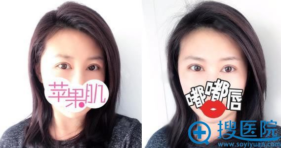 �ұ�������������˫��Ƥ6��Ч��