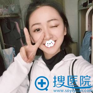 成都医美刘倩双眼皮真人案例 成都医美刘倩双眼皮真人案例