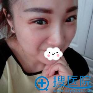 ��ľ˹����������ҽԺ�п�˫��Ƥ����