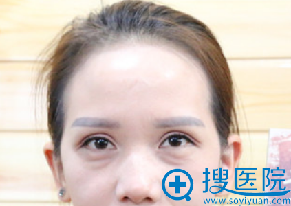 20180716_1531725965861557.png image.png