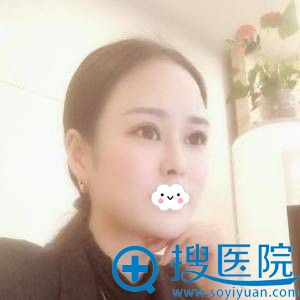 <!--<i data=20240710 data-id=12088></i>-->眼部综合整形效果怎么样 <!--<i data=20240710 data-id=12088></i>-->眼部综合整形效果怎么样