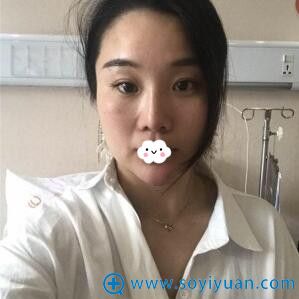 看我半肋鼻综合修复案例了解杭州正规华山连天美刘军怎么样?