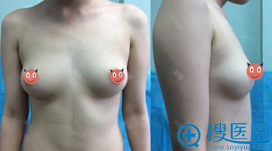 �����ұ���׿������(ԭ֪������)�����Ժ��������֬�����ؾ���