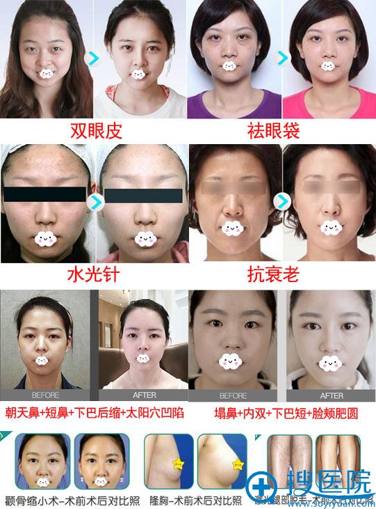 <!--<i data=20240710 data-id=11492></i>-->整形真人案例效果对比 <!--<i data=20240710 data-id=11492></i>-->整形真人案例效果对比