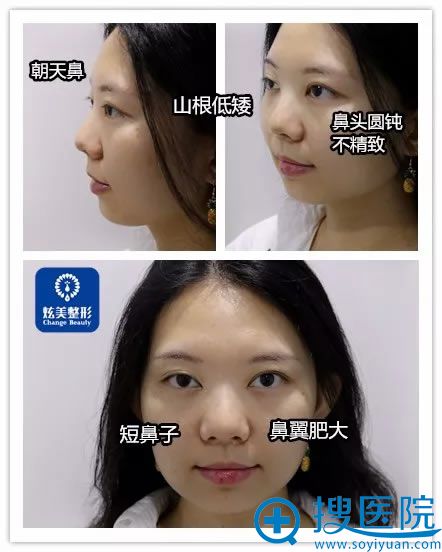 在<!--<i data=20240710 data-id=12618></i>-->找马群做鼻子前 在<!--<i data=20240710 data-id=12618></i>-->找马群做鼻子前