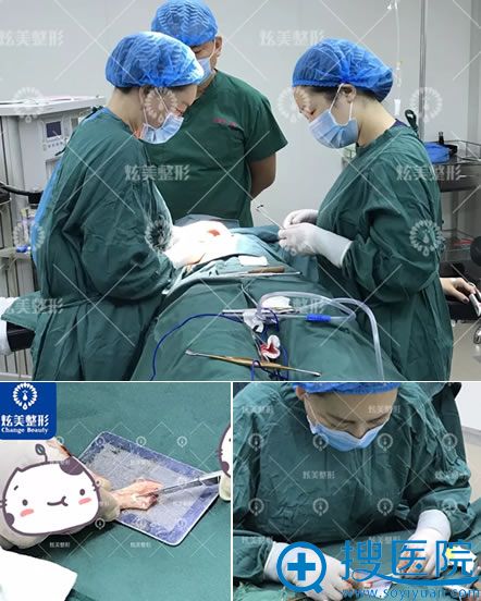 <!--<i data=20240710 data-id=12618></i>-->整形做肋骨隆鼻过程 <!--<i data=20240710 data-id=12618></i>-->整形做肋骨隆鼻过程