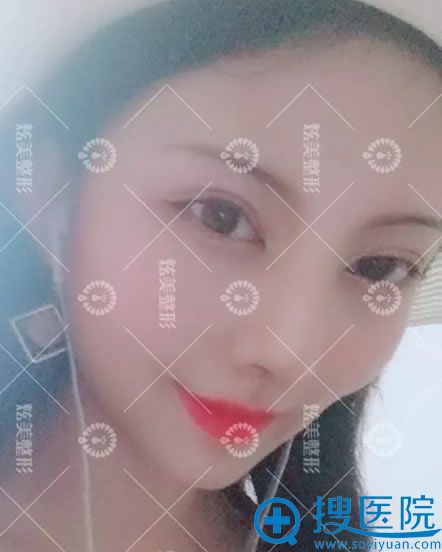 找<!--<i data=20240710 data-id=12618></i>-->马群做鼻子10天效果 找<!--<i data=20240710 data-id=12618></i>-->马群做鼻子10天效果